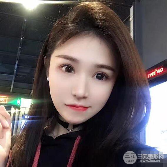 延吉金光善眼部整形失败修复前后对比图 三个月恢复自然