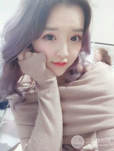 成都天使之翼张劲松切开双眼皮案例前后对比图心情小札