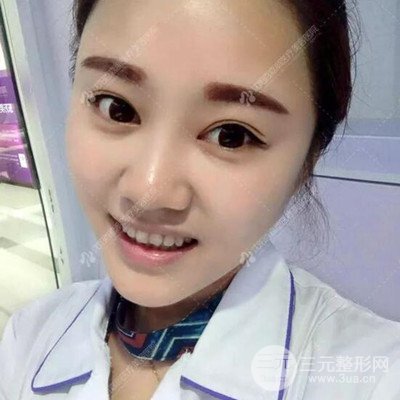 沈阳百嘉丽汪晓蕾自体脂肪面部填充恢复记录案例分享~