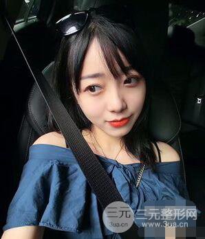 杭州华山连天美高俊明双眼皮案例前后对比图心情分享