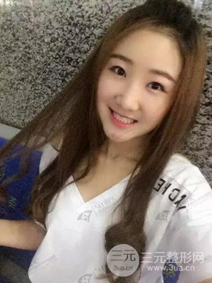 沈阳杏林史灵芝医生隆鼻整形案例日记分享~