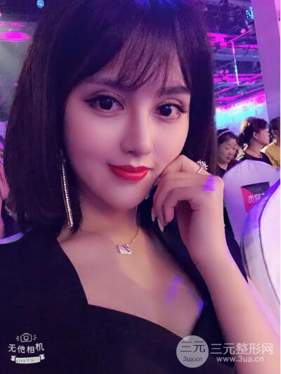 常州施尔美廉锋自体脂肪丰脸对照图案例心情日扎