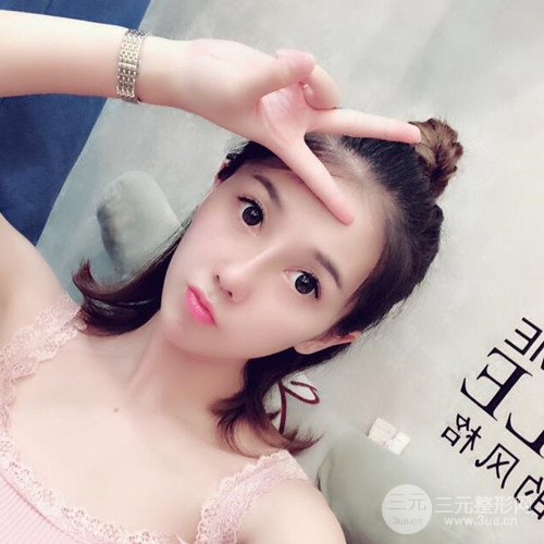 重庆五洲范文亮自体肋软骨隆鼻案例前后对比图分享~