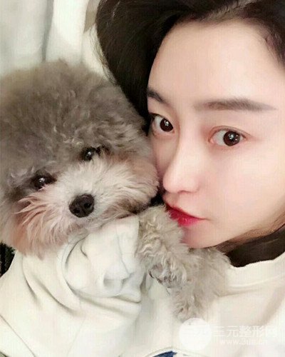 北京雍禾韩岩发际线种植手术半年了，分享前后果图片~