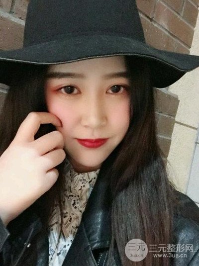 四川友谊李萍医生假体垫下巴前后对比果图片分享~