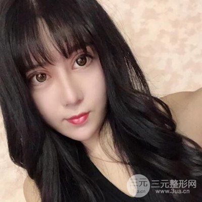 双眼皮修复案例恢复过程 双眼皮前后对比图分享