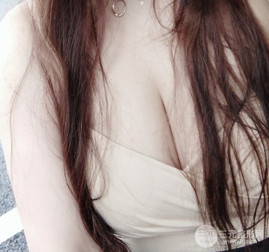 瑞美荟医疗美容诊所薛瑞院长假体隆胸丰胸案例展示果