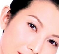 内窥镜提眉手术果理想吗?