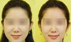 小脸美人怎样练成的？