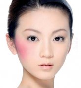八种方法去胎记,哪种适合您? 八种方法去胎记,哪种适合您?