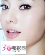 怎样隆鼻尖果好 怎样隆鼻尖果好