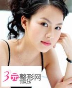 成都做埋线双眼皮要多少钱