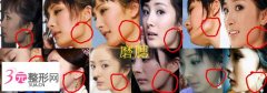 杨幂整容前后