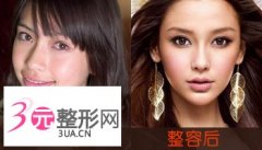 明星整容前后照片