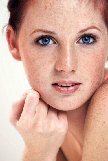 黄褐斑, 蝴蝶斑, 黑斑,雀斑,晒斑,老年斑,妊娠斑,血素斑等尾随而来