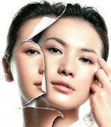 <b>彩光嫩肤去斑除皱</b> <b>彩光嫩肤去斑除皱</b>