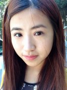 <b>做了双眼皮 消肿挺快啊</b> <b>做了双眼皮 消肿挺快啊</b>