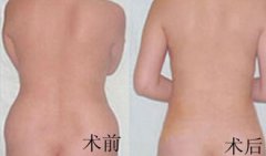 <b>上海九院注射瘦小腿果怎么样呢?</b>