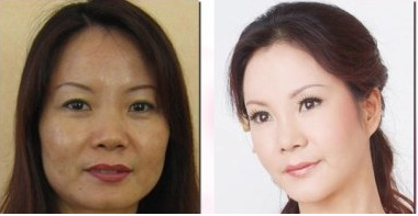四川黑脸娃娃可以美白吗