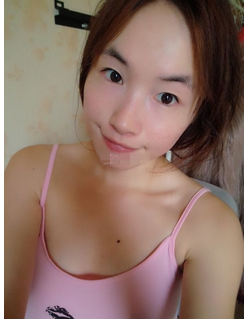 割了双眼皮变化真的炒鸡大啊