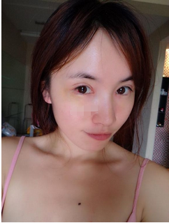割了双眼皮变化真的炒鸡大啊