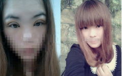 <b>我的双眼皮，且割且珍惜</b>