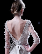 四川激光去胎记有什么优势?