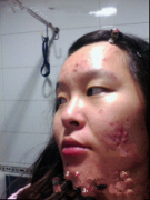 大美妞的祛痘经历 屌丝女逆袭白富美