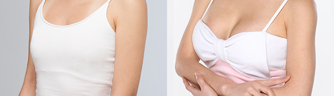 注射隆胸取出时间需要多久