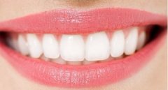 镶牙的种类有哪些 镶牙有哪些不同的种类