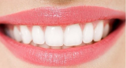 镶牙的种类有哪些 镶牙有哪些不同的种类