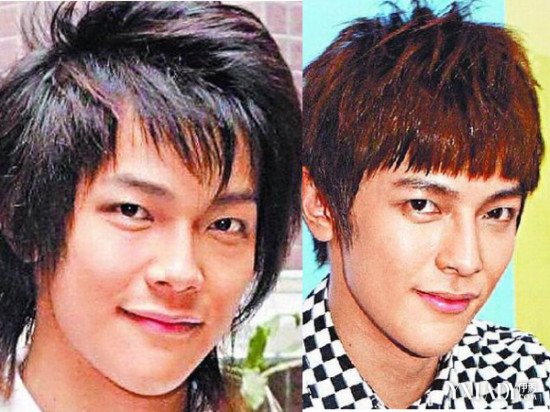 娱乐圈那些男士下颌角整形的成功案例