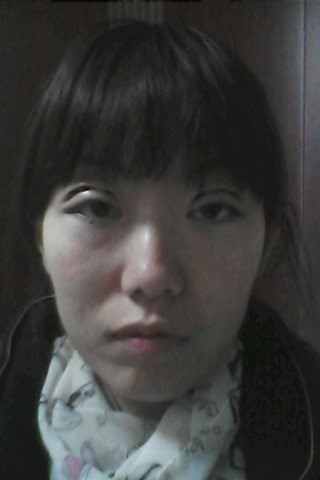 【三点定位双眼皮】三点定位双眼皮过程,三点定位双眼皮价格