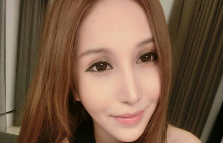 【开眼角前后对比照片】开眼角前后对比图