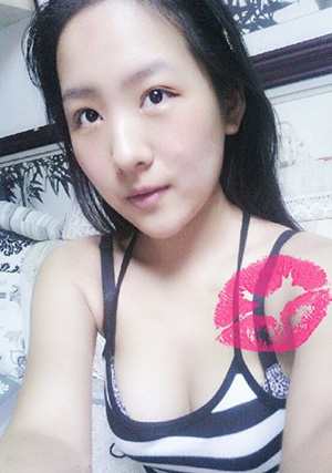 【开眼角手术医院】开眼角手术哪个医院好