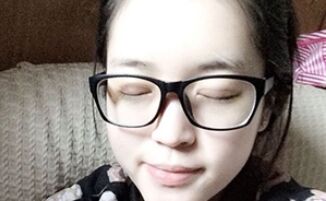 【压线双眼皮】压线双眼皮是永.久的吗?