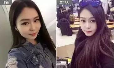 B****一支要多少钱,打B****前后果图