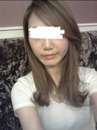 打注射瘦脸B****的价格是多少,注射瘦脸B****副作用