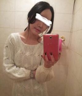 打注射瘦脸B****的价格是多少,注射瘦脸B****副作用