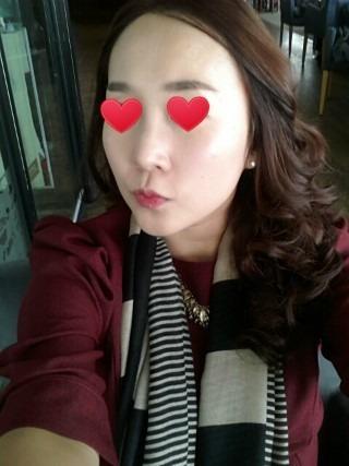 注射式隆鼻要多少钱价格,注射玻尿酸隆鼻整容医院哪里好