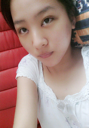 开眼角手术前后对比照片果图 开眼角手术有什么后遗症吗