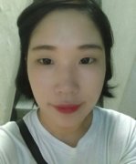 埋线法双眼皮手术果照片图 做埋线法双眼皮后恢复过程组图 埋线法双眼皮手术果照片图 做埋线法双眼皮后恢复过程组图