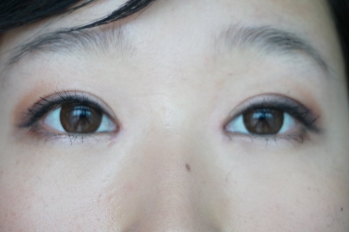 内双适合做双眼皮手术吗 内双割双眼皮好看吗