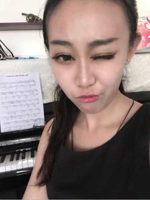 三点定位双眼皮手术的价格多少钱 开双眼皮手术有什么后遗症吗