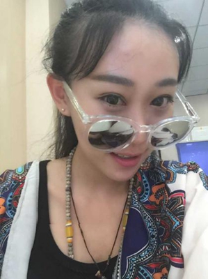 三点定位双眼皮手术的价格多少钱 开双眼皮手术有什么后遗症吗