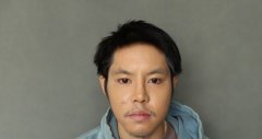 王艇隆鼻手术怎么样 王艇隆鼻手术多少钱价格