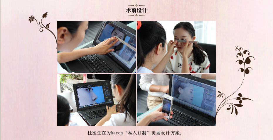 王艇隆鼻手术怎么样 王艇隆鼻手术多少钱价格