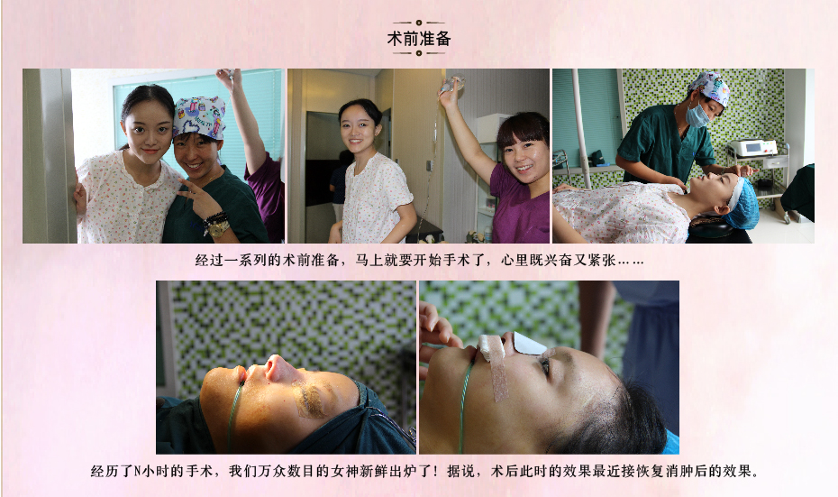 王艇隆鼻手术怎么样 王艇隆鼻手术多少钱价格