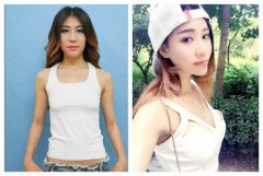 隆胸失败修复多少钱价格 隆胸手术失败修复哪家医院好