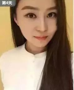 打B****Z长能保持多长时间 打B****前后果对比照片图